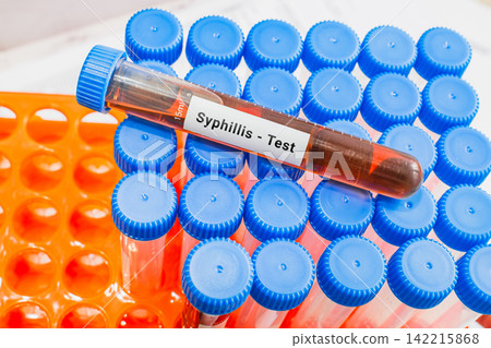 blood sample in lab test tube for Syphillis 142215868