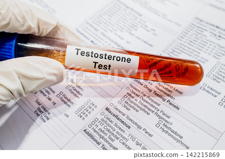 blood sample in lab test tube for Testosterone blood sample in lab test tube for Testosterone 142215869