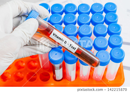 blood sample in lab test tube for vitamin D blood sample in lab test tube for vitamin D 142215870