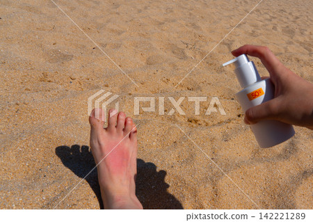 Sunburn on a girl's leg on the beach, skincare for summer holiday in South Korea Sunburn on a girl's leg on the beach, skincare for summer holiday in South Korea 142221289