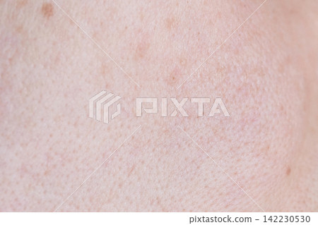 Facial Skin Showing Small Pores And Light Pigmentation In Close Up Clinical Detail On Cheek Surface Facial Skin Showing Small Pores And Light Pigmentation In Close Up Clinical Detail On Cheek Surface 142230530