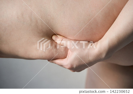 Hand Pinching Abdomen Skin Showing Body Fat Close Up In Neutral Indoor Setting With Soft Light Hand Pinching Abdomen Skin Showing Body Fat Close Up In Neutral Indoor Setting With Soft Light 142230652