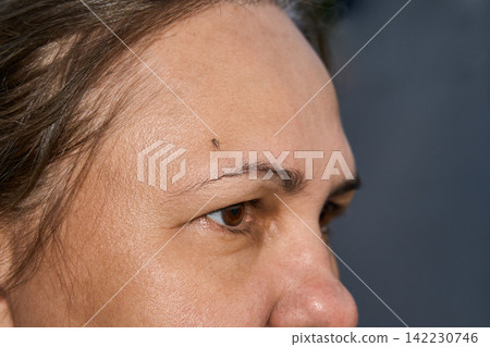 Close-Up Face Of Woman With Small Insect On Forehead Against Blurred Dark Background Close-Up Face Of Woman With Small Insect On Forehead Against Blurred Dark Background 142230746