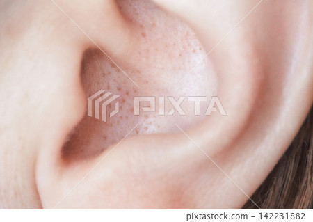 Ear Inner Skin Closeup Showing Visible Pores And Tiny Hairs At Ear Canal And Concha In Clinical Ear Inner Skin Closeup Showing Visible Pores And Tiny Hairs At Ear Canal And Concha In Clinical 142231882