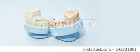 Dental Plaster Paired Upper And Lower Arch Casts With Occlusal Alignment And Marked Molar Teeth 142231901