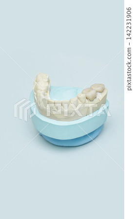 Dental Plaster Cast Presenting Lower Dental Arch With Premolars And Molars Standing On Soft Blue Dental Plaster Cast Presenting Lower Dental Arch With Premolars And Molars Standing On Soft Blue 142231906