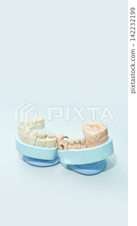 Dental Cast Models Resting On Blue Supports On Pale Minimal Studio Background With Isolated Dental Dental Cast Models Resting On Blue Supports On Pale Minimal Studio Background With Isolated Dental 142232199
