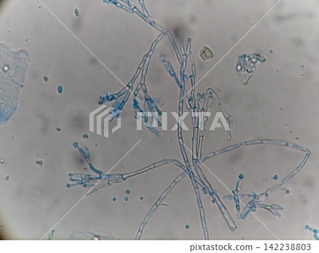 Blue mold used to make fermented foods Blue mold used to make fermented foods 142238803