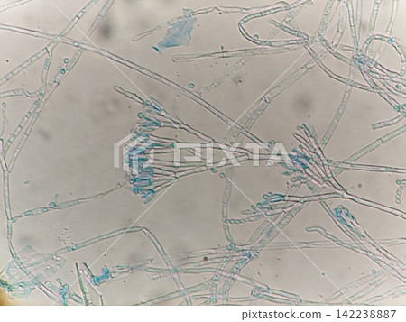 Microscopic image clearly showing the conidial structure of the genus Penicillium. Microscopic image clearly showing the conidial structure of the genus Penicillium. 142238887