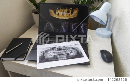 Laptop Displaying Dental 3D CBCT Tomography Software with Printed Jaw Panoramic X-Ray on Keyboard Laptop Displaying Dental 3D CBCT Tomography Software with Printed Jaw Panoramic X-Ray on Keyboard 142268526
