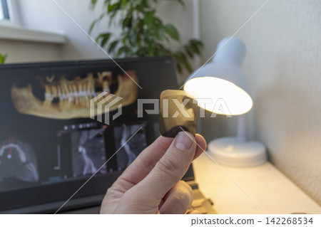 First-Person View of Dentist Hand Holding Dental Intraoral X-Ray Film Snippet in Front of Window First-Person View of Dentist Hand Holding Dental Intraoral X-Ray Film Snippet in Front of Window 142268534
