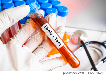 blood sample in lab test tube for Ebola blood sample in lab test tube for Ebola 142289628
