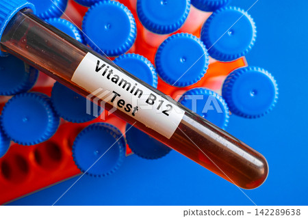 blood sample in lab test tube for Vitamin B12 blood sample in lab test tube for Vitamin B12 142289638
