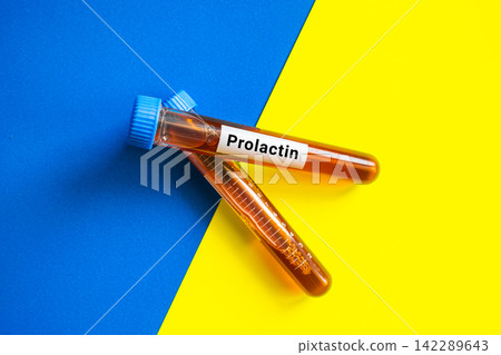 blood sample in lab tube for Prolactin test blood sample in lab tube for Prolactin test 142289643