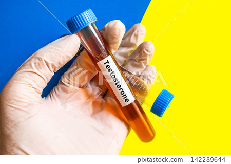 blood sample in lab tube for Testosterone test blood sample in lab tube for Testosterone test 142289644