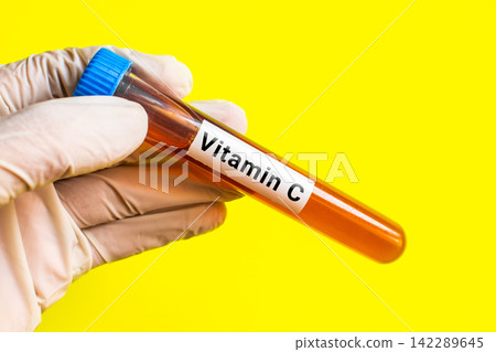 blood sample in lab tube for Vitamin C test blood sample in lab tube for Vitamin C test 142289645