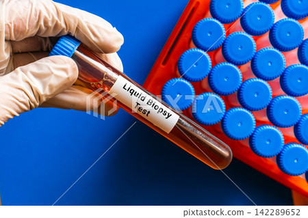 blood sample in lab tube for Liquid Biopsy test blood sample in lab tube for Liquid Biopsy test 142289652