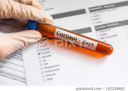 blood sample in lab tube for Cortisol test blood sample in lab tube for Cortisol test 142289662