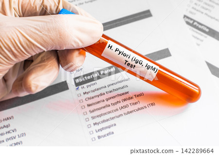 blood sample in lab tube for Helicobacter Pilory test 142289664
