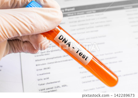 blood sample in lab tube for DNA test blood sample in lab tube for DNA test 142289673