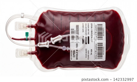 Medical blood bag filled with dark red plasma and plastic tubing donation transfusion healthcare hospital clinical medicine lifesaving equipment laboratory emergency treatment pathology Medical blood bag filled with dark red plasma and plastic tubing donation transfusion healthcare hospital clinical medicine lifesaving equipment laboratory emergency treatment pathology 142332997