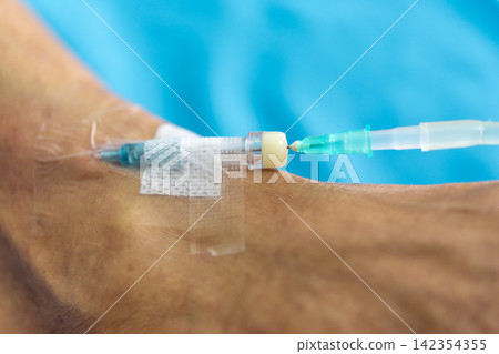 Closeup of an intravenous IV cannula secured medical tape patient arm for fluid medication hospital treatment Closeup of an intravenous IV cannula secured medical tape patient arm for fluid medication hospital treatment 142354355