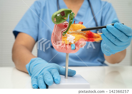 Pancreatitis, pancreatic cancer, Asian doctor with pancreas, gallbladder and bile duct human anatomy model at hospital. Pancreatitis, pancreatic cancer, Asian doctor with pancreas, gallbladder and bile duct human anatomy model at hospital. 142360257