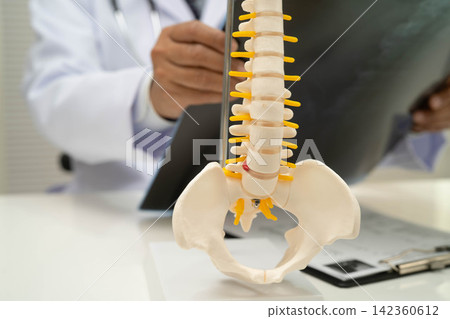 Doctor examining spine bone radiography xray film. 142360612