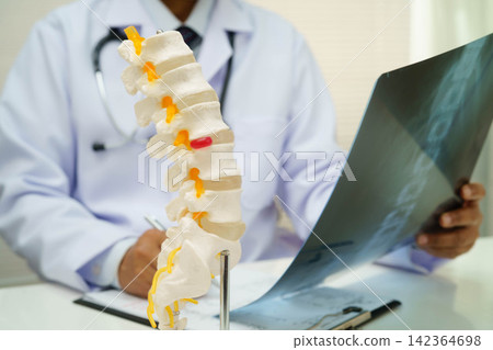 Doctor examining spine bone radiography xray film. Doctor examining spine bone radiography xray film. 142364698