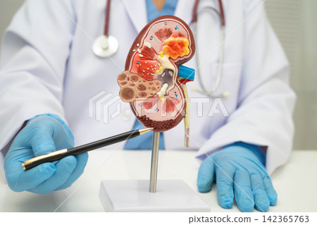 Chronic kidney disease, doctor with model for treatment urinary system, urology, Estimated glomerular filtration rate eGFR. Chronic kidney disease, doctor with model for treatment urinary system, urology, Estimated glomerular filtration rate eGFR. 142365763