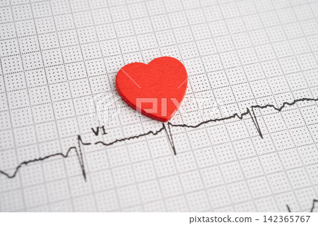Electrocardiogram ECG heart wave, heart attack, cardiogram report. Electrocardiogram ECG heart wave, heart attack, cardiogram report. 142365767