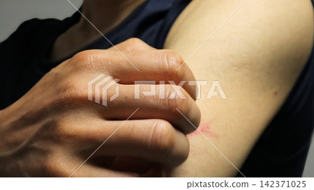 Close-up of a person scratching his arm Close-up of a person scratching his arm 142371025