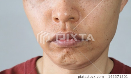 Japanese men's skin after skincare Japanese men's skin after skincare 142371201