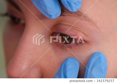 professional eye examination in a medical setting with close-up perspective and blue gloves on the person's hand, highlighting the clinical and healthcare context. professional eye examination in a medical setting with close-up perspective and blue gloves on the person's hand, highlighting the clinical and healthcare context. 142379257