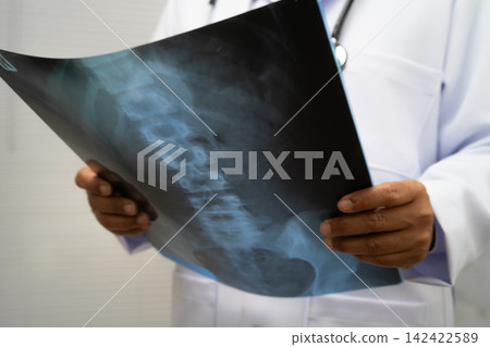 Doctor examining spine bone radiography xray film. Doctor examining spine bone radiography xray film. 142422589