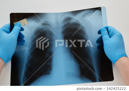 Doctor Examining Chest X-Ray Film With Gloved Hands in Medical Clinic Radiology Setting Doctor Examining Chest X-Ray Film With Gloved Hands in Medical Clinic Radiology Setting 142425222