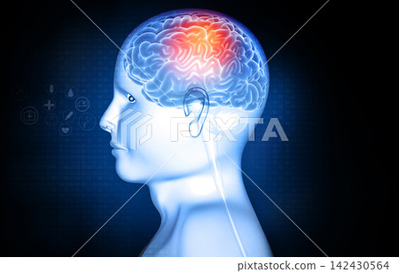 Human brain injury, damage,hemorrhag 142430564