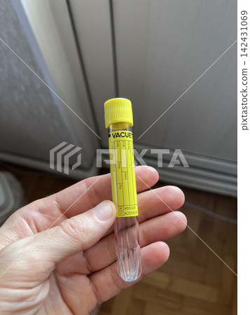 Hand holding blood collection tube 142431069