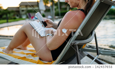 Woman looking at data in diabetes app on smartphone, wearing CGM sensor on arm. Woman looking at data in diabetes app on smartphone, wearing CGM sensor on arm. 142437658
