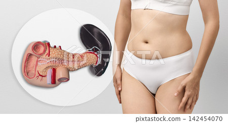 Woman in white underwear standing next to a detailed anatomical model of the pancreas and spleen. Acute pancreatitis treatment and insulin resistance diagnostics Woman in white underwear standing next to a detailed anatomical model of the pancreas and spleen. Acute pancreatitis treatment and insulin resistance diagnostics 142454070