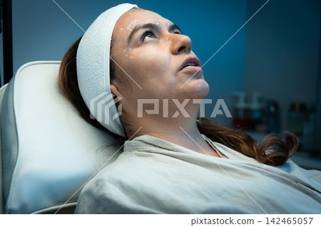 Reclining patient with white facial mapping marks Reclining patient with white facial mapping marks 142465057