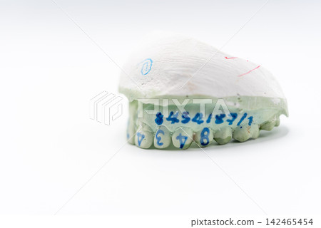 Dental cast model marked teeth used for laboratory study treatment planning prosthetic restoration professional dental technician work Dental cast model marked teeth used for laboratory study treatment planning prosthetic restoration professional dental technician work 142465454