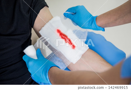 Nurse dressing wound for patient's hand with deep skin cutting. Nurse dressing wound for patient's hand with deep skin cutting. 142469915