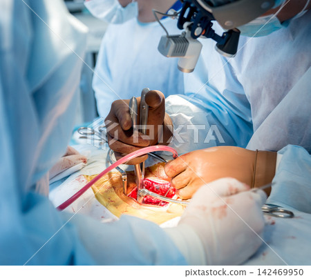 Spinal surgery. Group of surgeons in operating room with surgery equipment. Laminectomy Spinal surgery. Group of surgeons in operating room with surgery equipment. Laminectomy 142469950