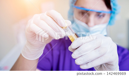 Platelet-Rich plasma preparation. Tube with plasma in hands 142469989