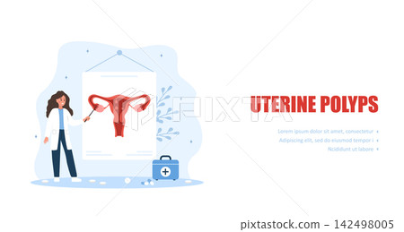 Uterine polyps concept. Uterine disease. Reproductive system treatment. Flat vector illustration Uterine polyps concept. Uterine disease. Reproductive system treatment. Flat vector illustration 142498005