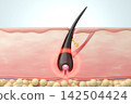 Cross-sectional view of hair follicle and 3DCG illustration of hair papilla structure; explanation of scalp abnormalities and signs of hair thinning. 142504424