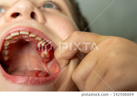 Child shows missing tooth with finger in mouth at home Child shows missing tooth with finger in mouth at home 142506804