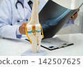 Doctor examining knee joint bone radiography xray film. 142507625