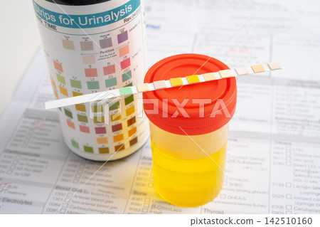Urinalysis, urine cup with reagent strip pH paper test and comparison chart in laboratory. Urinalysis, urine cup with reagent strip pH paper test and comparison chart in laboratory. 142510160